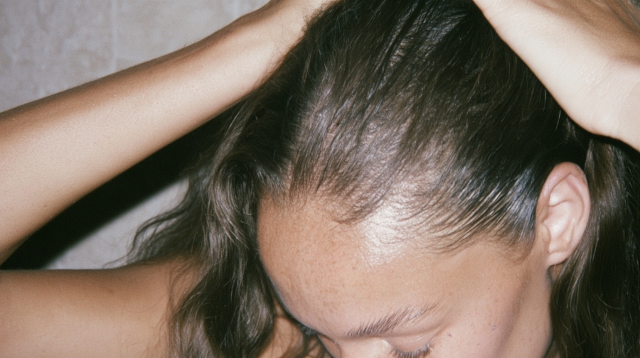 menopause hair thinning North Skin Mona Vale