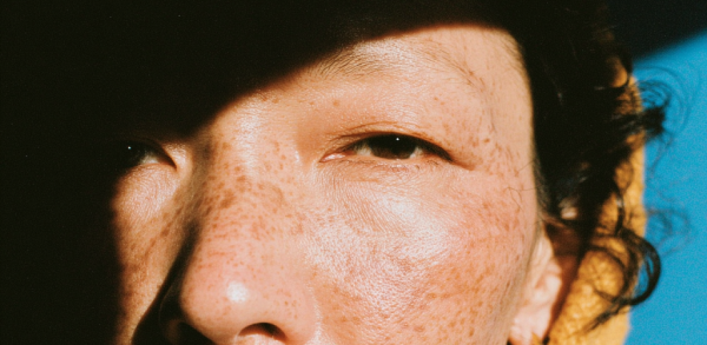 madsirv_close_up_of_older_womans_eyes_with_heavy_Dermatochala