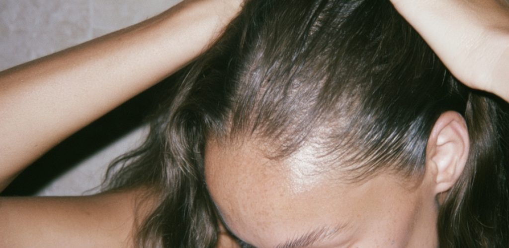 menopause hair thinning North Skin Mona Vale