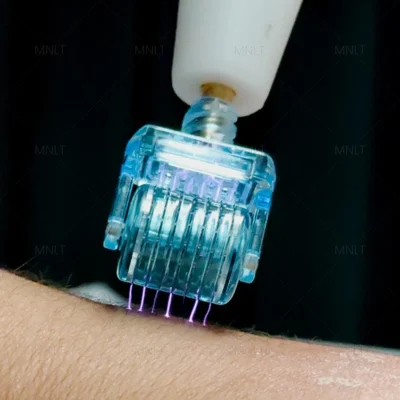 p2025030314053238f05