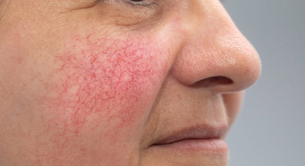 A,Closeup,And,Side,Profile,View,Of,A,Mature,Caucasian